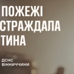 На Вінниччині під час пожежі постраждав підліток