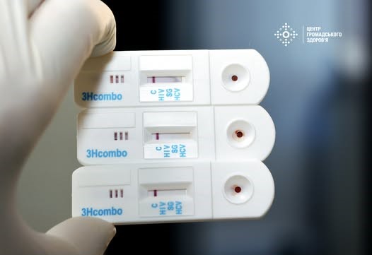 В Україні стартує Європейський тиждень тестування на ВІЛ та гепатити