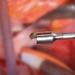 Проникаюче поранення серця: у Вінниці успішно прооперували молодого чоловіка