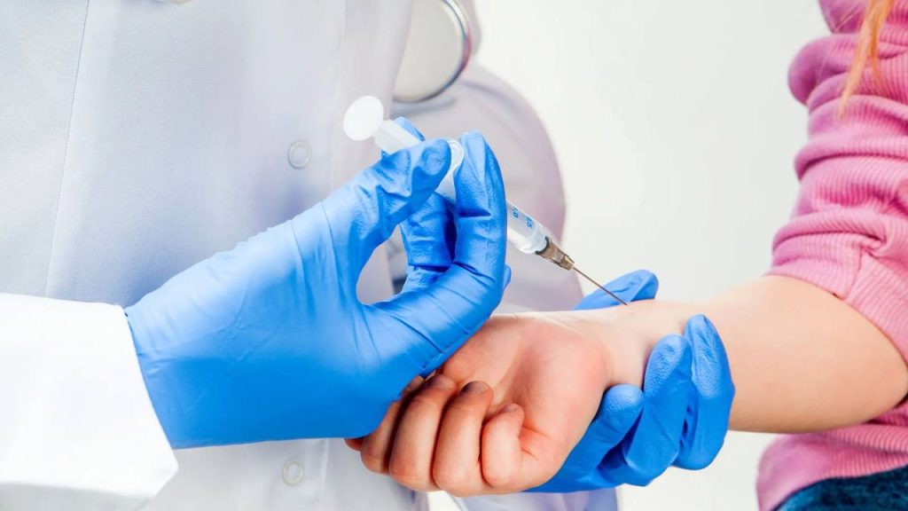 В Україні відмовляються від проби Манту: що зміниться з квітня