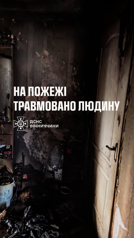 На Вінниччині під час пожежі чоловік отримав опіки, рятуючи дітей