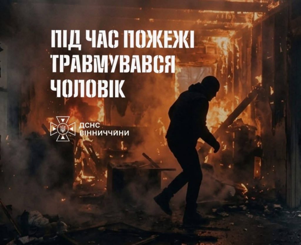 У Турбівській громаді пенсіонер отримав опіки через пожежу в оселі