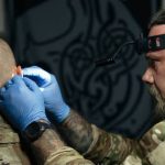 У Вінниці захисникам безкоштовно коригують рубці після травм та опіків: як скористатися програмою
