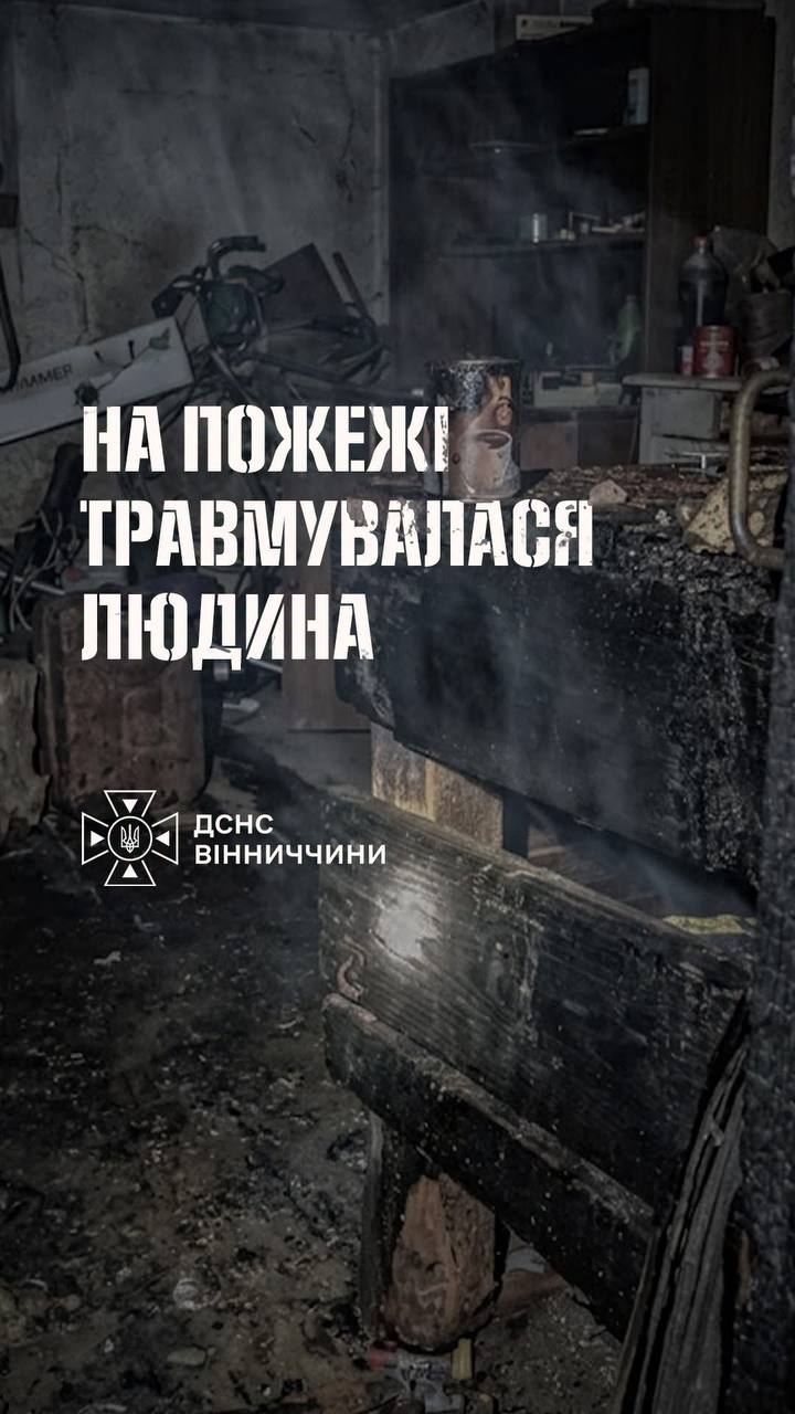 На Вінниччині під час пожежі травмувався 36-річний чоловік