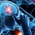 Які послуги невролога покриває НСЗУ та чи потрібне електронне направлення